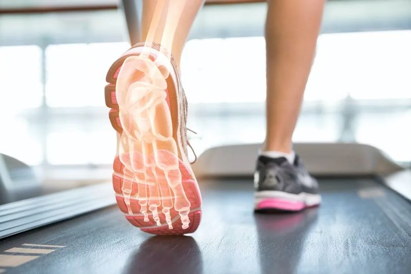 infortuni dovuti alla corsa: come prevenire la fascite plantare