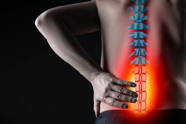 Sport e mal di schiena: come affrontare il problema